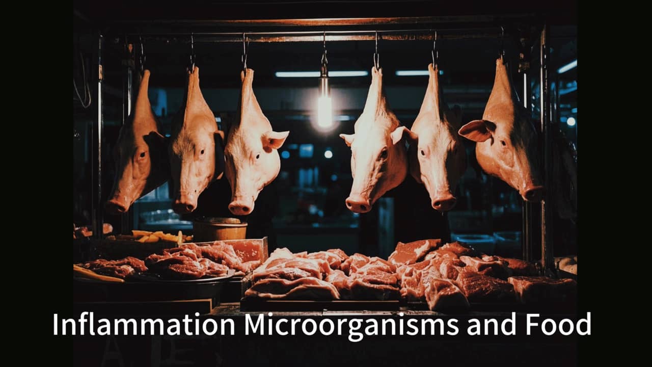 Inflammation Microorganisms and Food